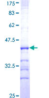 12.5% SDS-PAGE Stained with Coomassie Blue.